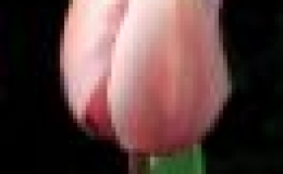Lumbalgia